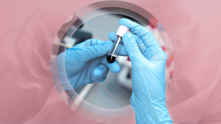 Онкоскрининг для взрослых какие обследования действительно нужны